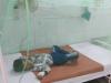 बरेली: 6 वर्षीय बच्चे में मलेरिया की पुष्टि