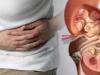 जानें पेट में पथरी होने के क्या हैं कारण, लक्षण और उपचार
