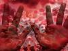 Monkeypox outbreak : रूस में मंकीपॉक्स का पहला केस, द. कोरिया में कोरोना के 37360 नए मामले दर्ज