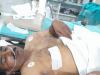 वाराणसी: दरोगा को गोली मारकर बदमाशों ने लूटी सरकारी पिस्टल