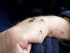 Poison for Mosquitoes: मच्छरों के लिए जहर से कम नहीं किचन की ये 5 चीजें, ऐसे करें यूज 