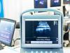 रुद्रपुर: जिला अस्पताल में लगाई दूसरी अल्ट्रासाउंड मशीन, मिल पाएगी मरीजों को राहत