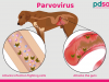 हल्द्वानी: सावधान! कुत्तों में फैल रहा पार्वो वायरस