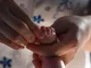 MP में निमोनिया के इलाज के लिए शिशु को गर्म लोहे की छड़ से दागा गया: जांच के आदेश 