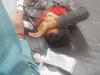 बहराइच: कोल्हू मशीन में गन्ना लगाते समय बालक का हाथ कटा, गंभीर हालत में जिला अस्पताल किया गया रेफर