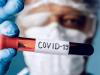 कोविड-19 के 605 आए नए मामले, चार मरीजों की मौत, उपचाराधीन मरीजों की संख्या हुई 3,643