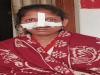 गोंडा: घरेलू विवाद में पति ने दांत से काटी पत्नी की नाक, केस दर्ज