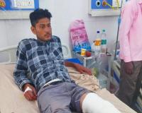 मुरादाबाद  : राज्य कर अधिकारी के स्टोनो से लूट करने वाला आरोपी मुठभेड़ में दबोचा गया, कांस्टेबल भी घायल