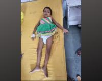 बरेली: समय पर नहीं कराया बुखार का इलाज, 4 साल की बच्ची की दोनों किडनी फेल