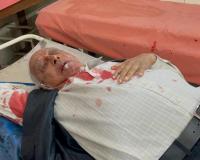 बरेली: अफसरों के ''सफेद झूठ'' ने बुजुर्ग कमल मेहरा को पहुंचाया अस्पताल