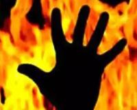 रामपुर: संदिग्ध परिस्थितियों में घर में लगी आग से झुलसा युवक, मौत