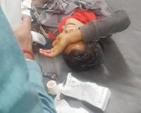 बहराइच: कोल्हू मशीन में गन्ना लगाते समय बालक का हाथ कटा, गंभीर हालत में जिला अस्पताल किया गया रेफर