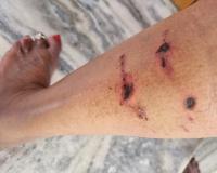 बरेली: सिविल लाइंस में कुत्तों ने महिला को दौड़ाकर काटा, पॉश कालोनी में आतंक से लोग परेशान