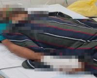 सुलतानपुर: खाने के दौरान मारपीट, सुलह के लिए बुला कर युवक को मार दी गोली
