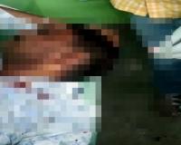 सुलतानपुर: युवक पर ईंट पत्थर और असलहे के बट से हमला, मेडिकल कॉलेज में चल रहा इलाज 