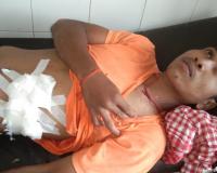 खटीमा: मगरमच्छ के हमले से युवक हुआ घायल