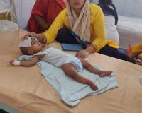 Bareilly News: गर्मी में डायरिया का कहर, एक बेड पर दो-दो बच्चे भर्ती