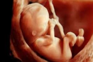 मारपीट से गर्भवती के गर्भ में शिशु की मौत, मुकदमा दर्ज होने के बाद आरोपी फरार