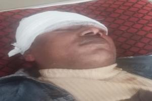 मुरादाबाद : भतीजे के साले ने मजदूर पर किया कुल्हाड़ी से हमला