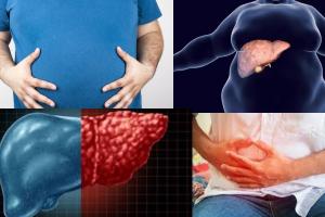 Fatty Liver Disease: फैटी लिवर होने पर इन बातों का रखें ध्यान, जल्द मिलेगा आराम