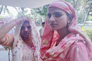 मुरादाबाद : पिता से मिलने आई बहन का भाई ने ईंट से फोड़ा सिर, बचाने आई दूसरी बहन को भी पीटा