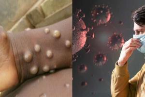 Monkeypox virus: शरीर में दिख रहे हैं यह लक्षण, तो इन जांचों से लगाये वायरस का पता