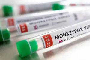 सावधान: Monkeypox से बच्चों को ज्यादा खतरा, लक्षणों पर रखनी होगी कड़ी नजर