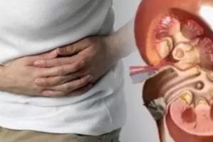 जानें पेट में पथरी होने के क्या हैं कारण, लक्षण और उपचार