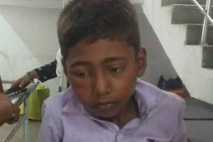 बाराबंकी: विद्यालय की छत से गिरकर किशोर हुआ घायल, अस्पताल में भर्ती