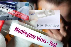 हायो रब्‍बा! इटली में शख्स को एक साथ हुआ HIV, Covid और Monkeypox