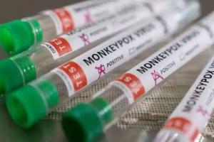 न्यूजीलैंड में मंकीपॉक्स से बचाव के लिए तैयार की ‘टेकोविरिमैट’ दवा, सितंबर के अंत से होगी वितरित