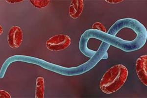 Ebola Case: पूर्वी युगांडा में तेजी से फैल रहा है इबोला वायरस, 135 मामले दर्ज