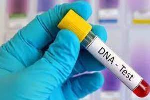 बांदा: डीएनए टेस्ट के लिये दुष्कर्म के आरोपी का लिया गया सैंपल, जानें पूरा मामला