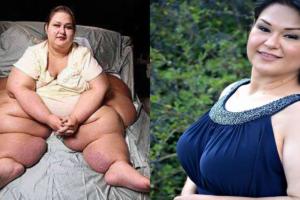Amazing Transformation: कभी इस महिला का वजन था साढ़े 4 क्विंटल, घर तोड़कर निकालना पड़ा था बाहर