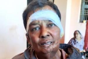 सुल्तानपुर: पूर्व प्रधान के पुत्र पर बदमाशों का हमला, घर में घुसकर चाकू से किये कई वार