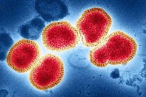 सावधानी बरतें, एच3एन2 वायरस से घबराने की आवश्यकता नहीं: विशेषज्ञ 
