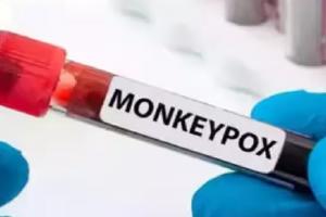 Pakistan : बलूचिस्तान में बढ़ा Monkeypox का खतरा, स्कूलों में हाई अलर्ट जारी 