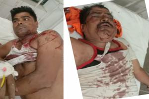 अयोध्या : रुदौली में मारपीट के दौरान मारी गोली, दो भर्ती