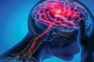 दर्द को मापना इतना कठिन क्यों है, और मस्तिष्क तरंगों पर अध्ययन कैसे मदद कर सकता है?