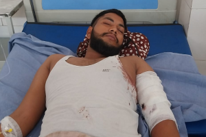 मुरादाबाद : पीली कोठी चौराहे पर दवा व्यापारी के नौकर को गोली मारी, जानिए वजह