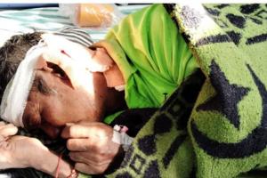 रामनगर: मोहान में बाघ के हमले से श्रमिक गंभीर रूप से घायल      