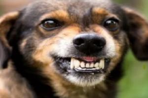 UP Dog attack : सोसाइटी में टहल रही एक महिला चिकित्सक को कुत्ते ने काटा, मामला दर्ज 