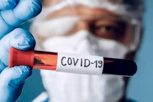 कोविड-19 के 605 आए नए मामले, चार मरीजों की मौत, उपचाराधीन मरीजों की संख्या हुई 3,643