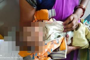 बाराबंकी: लोहिया अस्पताल में अब होगा दूधमुही अनन्या का इलाज, डॉक्टरों की मदद से हो सका संभव