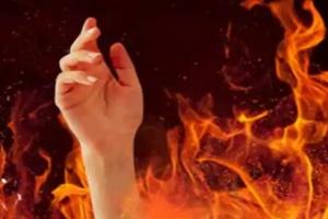 लखनऊ: आग से झुलसी महिला की मौत, पिता ने दामाद और बहन पर लगाया जलाकर मारने का आरोप