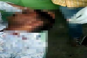सुलतानपुर: युवक पर ईंट पत्थर और असलहे के बट से हमला, मेडिकल कॉलेज में चल रहा इलाज 