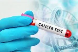 भारत में कैंसर संबंधी परीक्षण के लिए 'प्रोजेक्ट आशा' का नेतृत्व करेंगी भारतीय-अमेरिकी चिकित्सक 