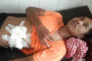 खटीमा: मगरमच्छ के हमले से युवक हुआ घायल